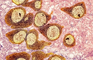 Prints of Brain nerve cells. Transmission electron micrograph (TEM) of a section through brain tissue from the cerebral cortex, showing numerous neurons (nerve cells) surrounded by axons and dendrites Images Dated 2012 August: Brain Nerve Cells Print, TEM Micrograph
