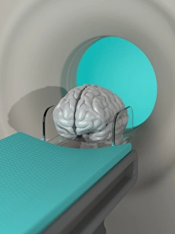 Medical Diagnostic Equipment Prints: Brain scan, conceptual artwork