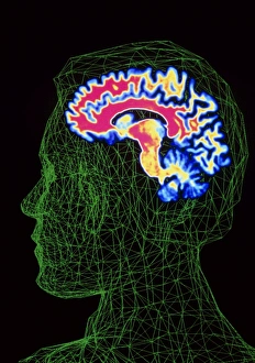 Brain scan superimposed on contour of human head Brain scan superimposed on contour of human head