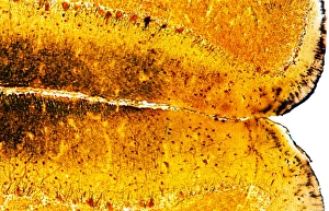 Light Microscopy Images Prints: Brain tissue, light micrograph