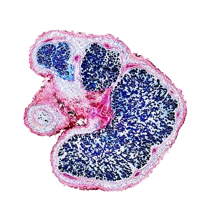 Light Microscopy Images Prints: Broad bean root nodules, light micrograph