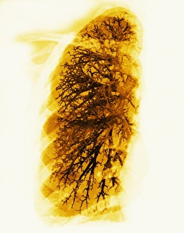 Lung Anatomy Prints: Bronchioles