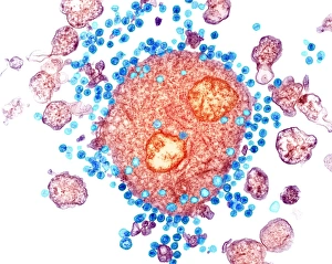 Transmission Electron Micrograph Prints: Budding HIV particles, TEM C018 / 0123
