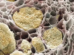 Cabbage root infection, SEM Cabbage root infection, SEM