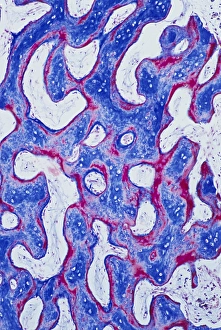Human Skeletal System Anatomy Prints: Cancellous bone, light micrograph C016 / 0509