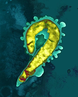 Capnocytophaga canimorsus bacterium, TEM Capnocytophaga canimorsus bacterium, TEM