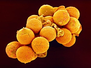 Cedar Pollen Print, SEM