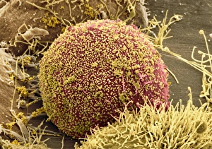 Human Immunodeficiency Virus Prints: Cell infected with HIV, SEM
