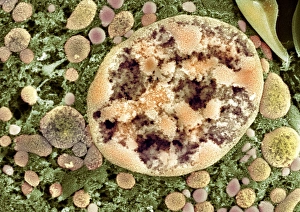 Coloured SEM Print of a Kidney Cell Nucleus