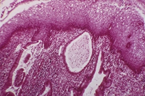 Light Micrograph Images Prints: Cervical cyst, light micrograph C015 / 6408