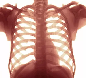 Images Dated 12th October 2005: Chest X-ray of a healhty human heart
