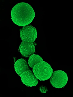Prints of Chlamydia bacteria. Coloured scanning electron micrograph of Chlamydia trachomatis bacteria Images Dated 2010 March: Print of Chlamydia trachomatis bacteria in coloured SEM
