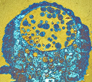 Transmission Electron Micrograph Prints: Chlamydia bacteria, TEM