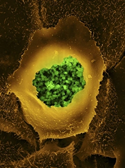 Coloured Scanning Electron Microscopy Prints: Chlamydia, SEM