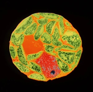 Chloroplasts in protoplast of tobacco Chloroplasts in protoplast of tobacco