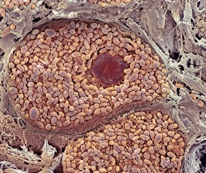 Prints of Choroid layer of the eye. Coloured scanning electron micrograph (SEM) of a section through the choroid layer of the eye. A pigment cell (dark brown) is at upper centre Images Dated 2005 March: SEM Print of Choroid Layer