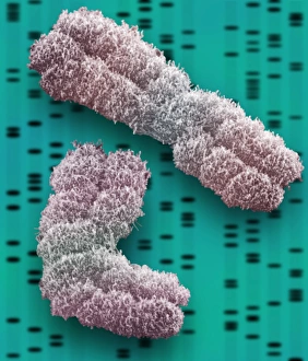 Prints of Chromosomes. Coloured scanning electron micrograph (SEM) of two chromosomes. The SEM is overlaid on a DNA autoradiogram background Images Dated 2004 January: SEM Chromosomes Print