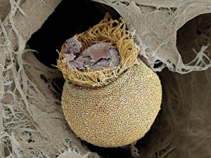 Ciliate protozoan, SEM Ciliate protozoan, SEM