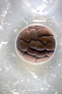 Cell Division Micrograph Prints: Cleavage in frog egg, light micrograph