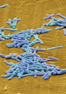 SEM Print of Clostridium difficile bacteria, coloured