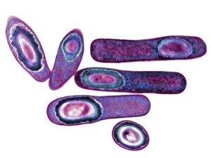 Framed Print : TEM Clostridium difficile print, 10cm wide