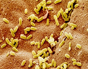Col. SEM of bacteria on toothbrush filament Col. SEM of bacteria on toothbrush filament