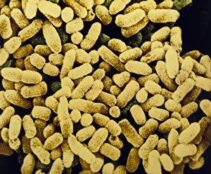 E Coli Bacteria Prints: Colony of E. coli bacteria