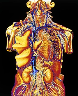 Colour artwork of abdominal & thoracic nerves Colour artwork of abdominal & thoracic nerves