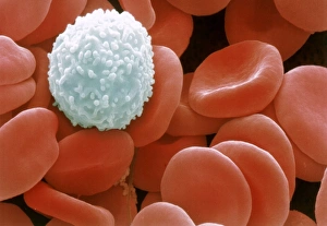 Colour SEM of red & white blood cells Colour SEM of red & white blood cells