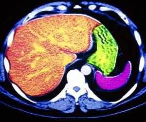 Images Dated 1st September 1994: Coloured CT scan of human spleen, stomach and liver