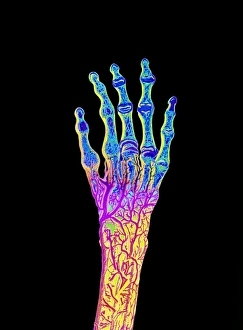 Coloured illustration of blood supply to hand Coloured illustration of blood supply to hand
