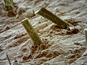 Coloured SEM of beard stubble on a mans face Coloured SEM of beard stubble on a mans face
