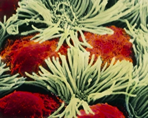 Coloured SEM of bronchial epithelium lining lung Coloured SEM of bronchial epithelium lining lung