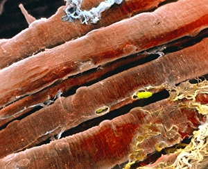 Coloured SEM of a bundle of skeletal muscle fibres Coloured SEM of a bundle of skeletal muscle fibres