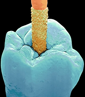 Coloured SEM of a dental drill drilling into tooth Coloured SEM of a dental drill drilling into tooth