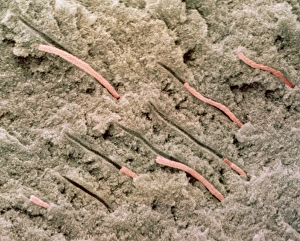 Coloured SEM of dentine with protoplasmic fibres Coloured SEM of dentine with protoplasmic fibres