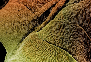 Coloured SEM of epithelial cells in the oesophagus Coloured SEM of epithelial cells in the oesophagus