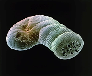 Coloured SEM of foraminiferan, Spirolina sp Coloured SEM of foraminiferan, Spirolina sp