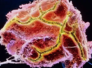 Coloured SEM of a liver cell known as hepatocyte Coloured SEM of a liver cell known as hepatocyte