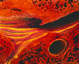 Coloured SEM of lung showing alveoli and bronchus Coloured SEM of lung showing alveoli and bronchus