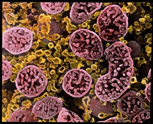 Coloured SEM of mitochondria in ovarian cells Coloured SEM of mitochondria in ovarian cells
