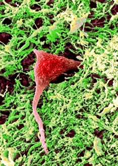 Coloured SEM of a nerve cell in brain tissue Coloured SEM of a nerve cell in brain tissue