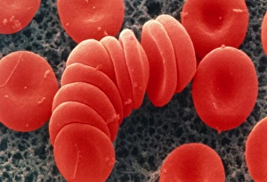 Coloured SEM of red blood cells, rouleau formation Coloured SEM of red blood cells, rouleau formation