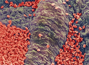 Coloured SEM of red blood cells on vessel wall Coloured SEM of red blood cells on vessel wall