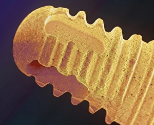 Coloured SEM of the root of a dental implant Coloured SEM of the root of a dental implant