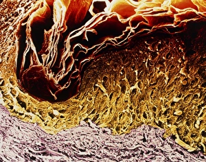 Coloured SEM of a section through skin Coloured SEM of a section through skin