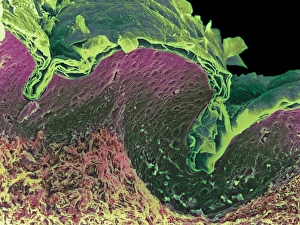 Coloured SEM of a section through skin layers Coloured SEM of a section through skin layers