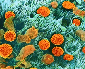Coloured SEM of trachea surface with pollen & dust Coloured SEM of trachea surface with pollen & dust