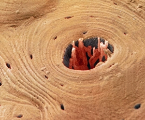Coloured SEM of transverse section of compact bone Coloured SEM of transverse section of compact bone