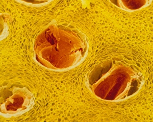 Coloured SEM of trichomes in lemon peel Coloured SEM of trichomes in lemon peel